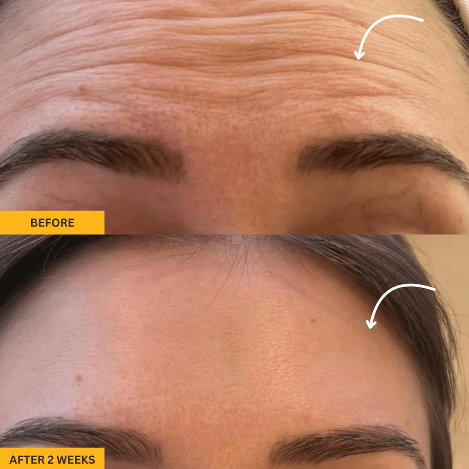Lymphatic Contour Face Brush™