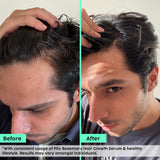 Rosemary Advanced Hair Growth Serum for Male Pattern Baldness | Promotes New Hair Growth