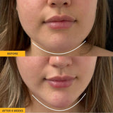 Lymphatic Contour Face Brush™