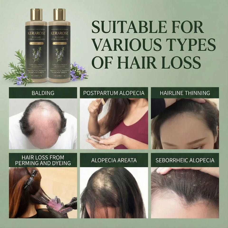 Kerarose Rosemary Shampoo For Hair Growth
