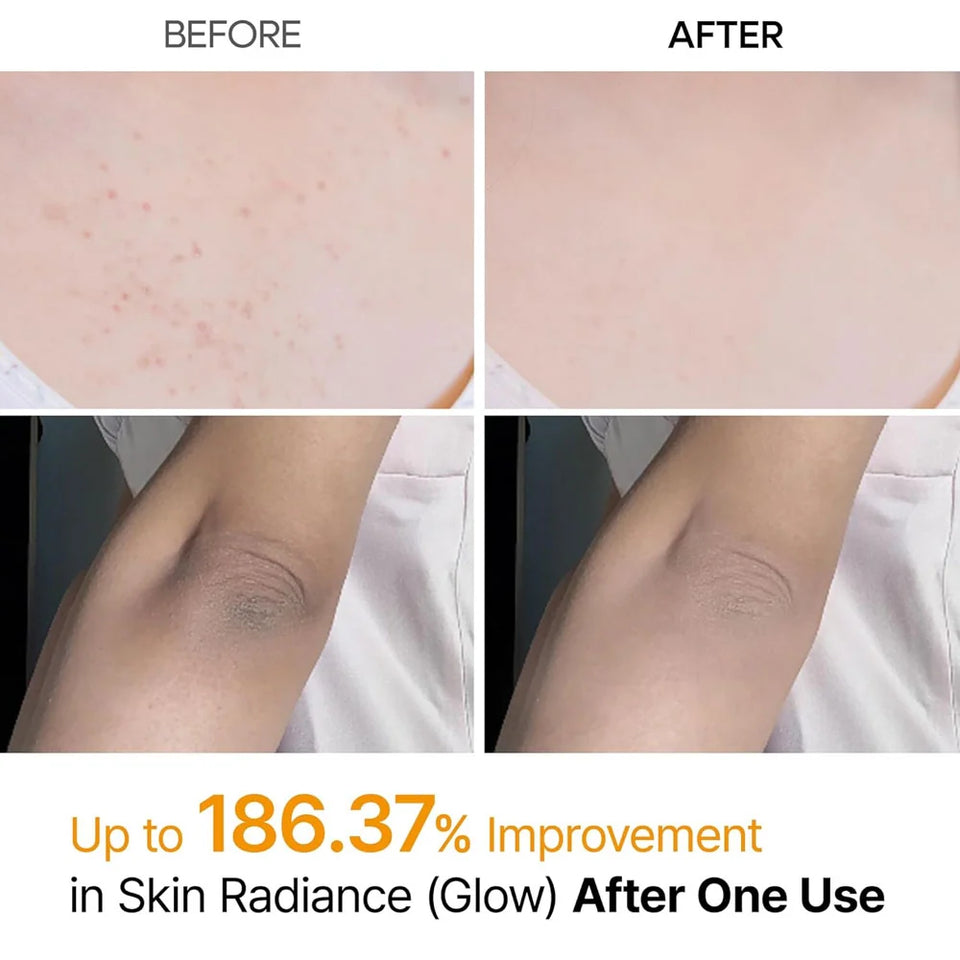 Dr.Melaxin Peel Shot Exfoliating Kojic Acid Turmeric Spray