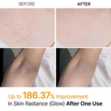 Dr.Melaxin Peel Shot Exfoliating Kojic Acid Turmeric Spray