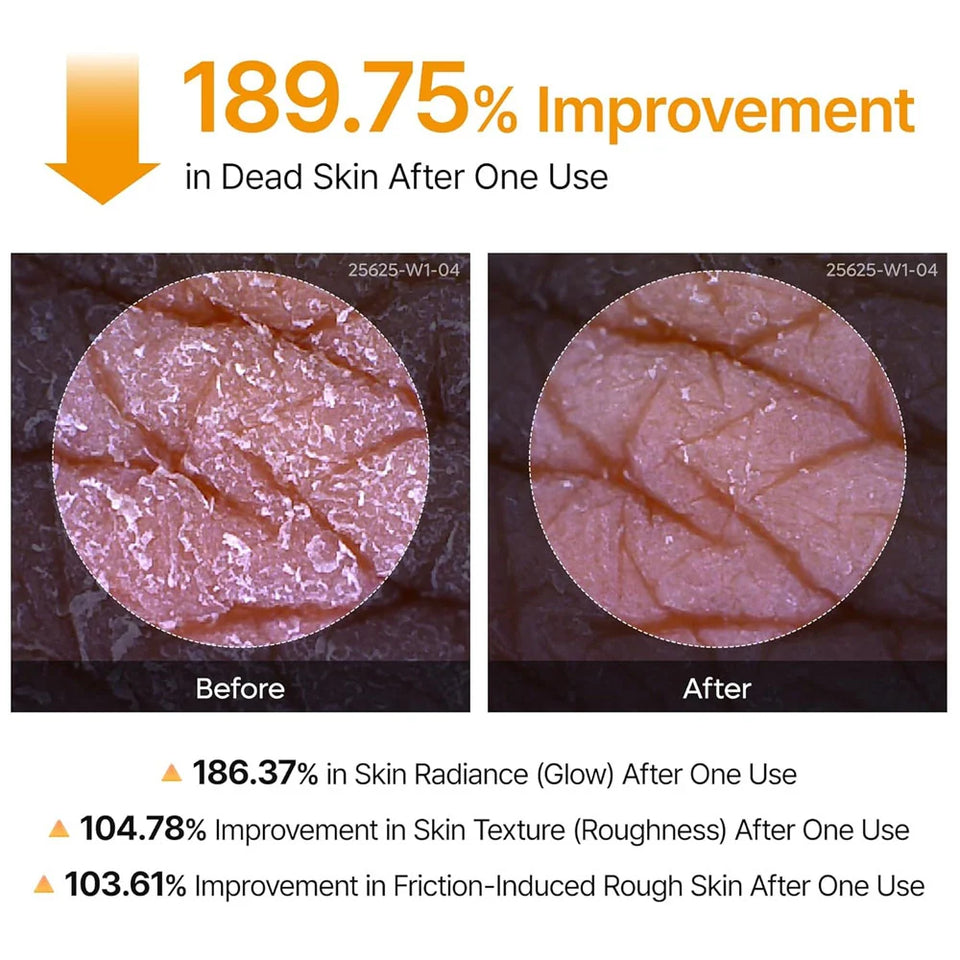 Dr.Melaxin Peel Shot Exfoliating Kojic Acid Turmeric Spray